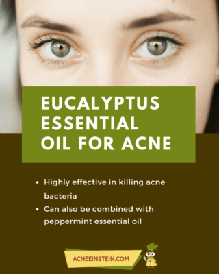 eukalyptus oil for acne