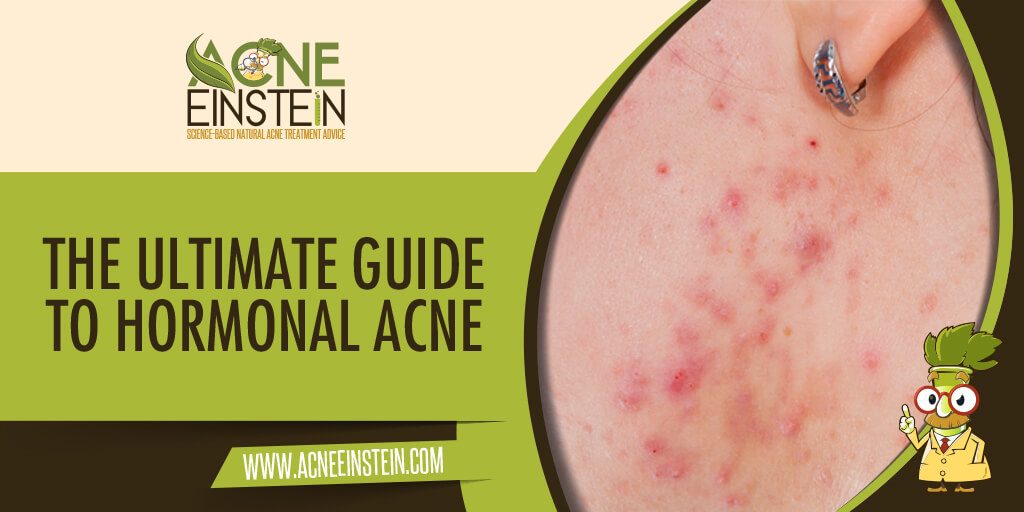 what foods reduce hormonal acne